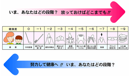 SI-index 